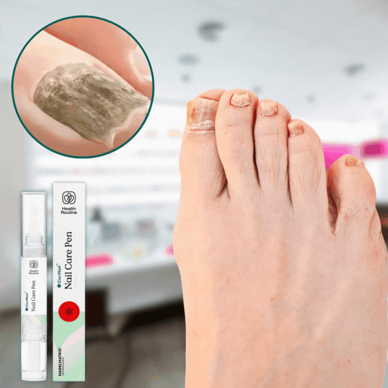 ClariNail™ SE