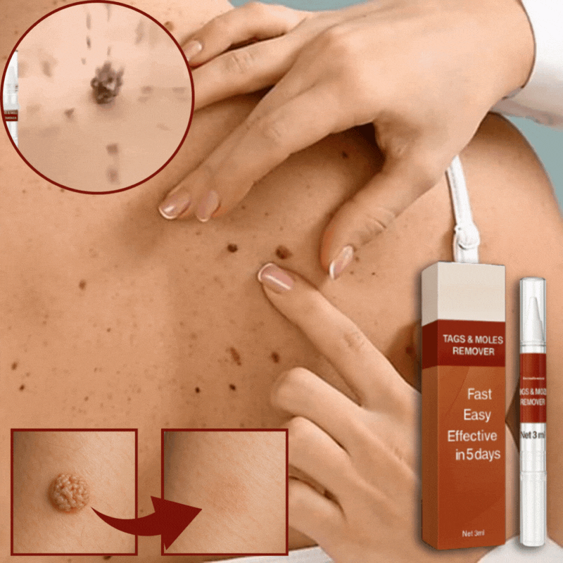 EpidermaFix®
