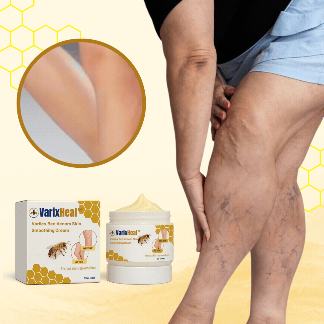 VarixHeal™ NL/BE