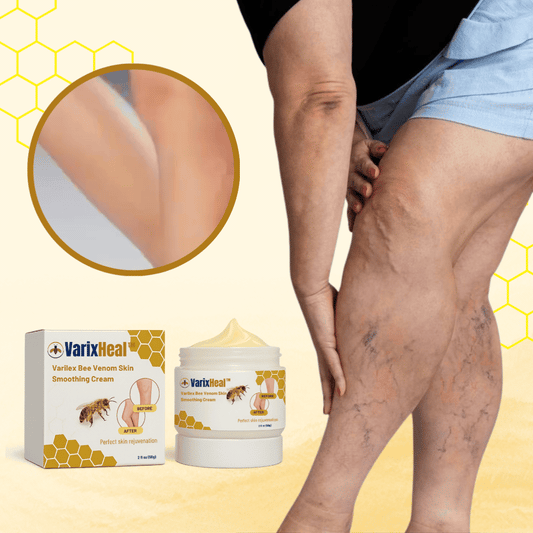 VarixHeal™ NL/BE